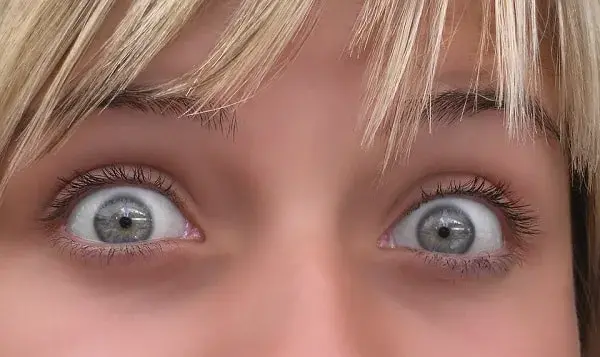 ojeras en los ojos